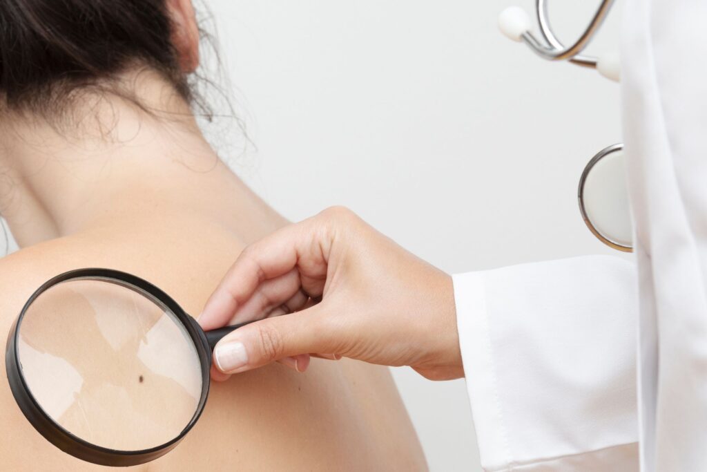 skin cancer specialist fairfax va