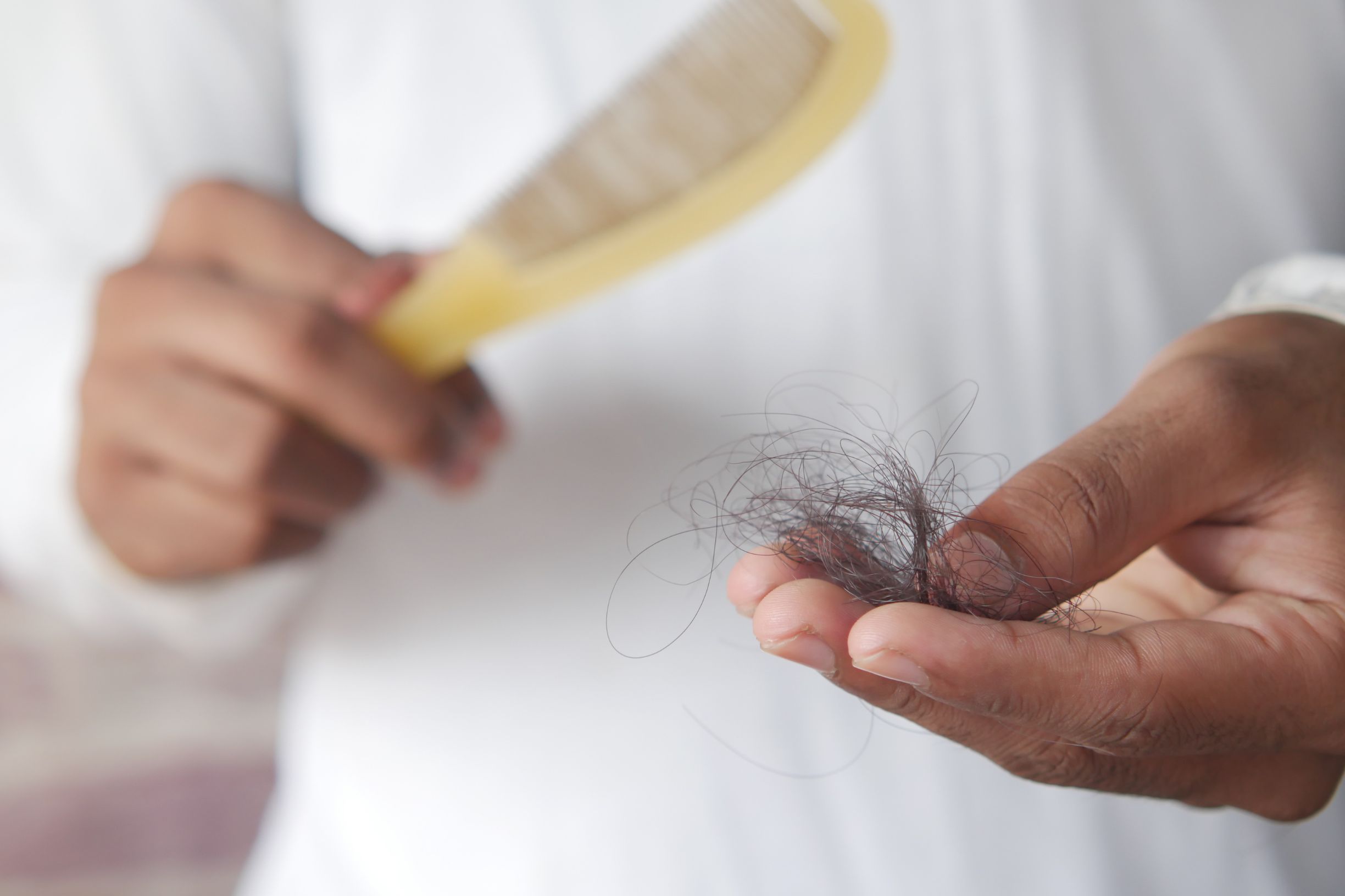 hair loss treatment in fairfax va