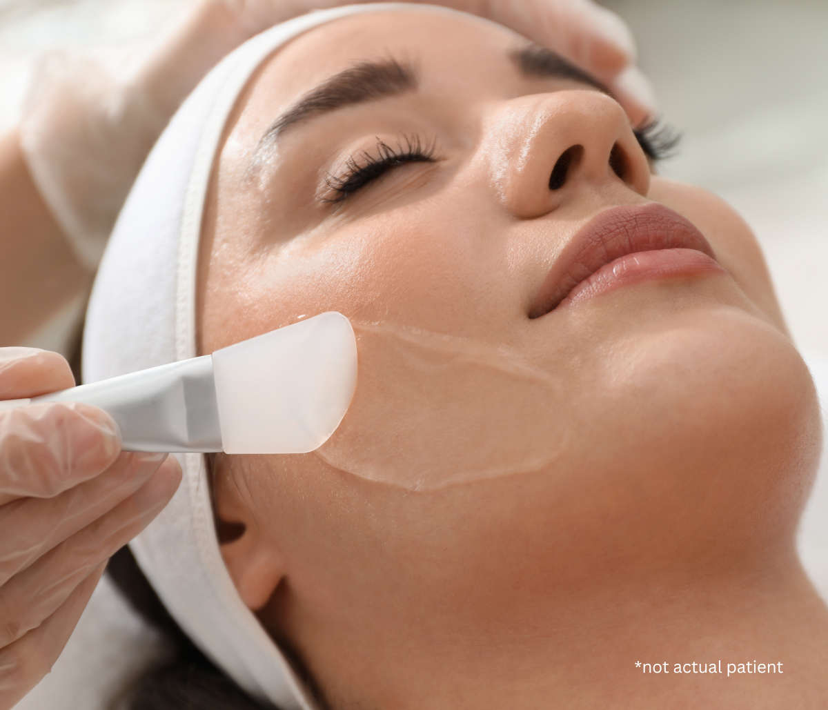 The Benefits of Chemical Peels from a Cosmetic Dermatologist in Northern VA