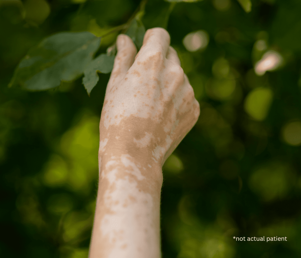 Finding the Best Skin Pigmentation Treatments in Fairfax, Virginia